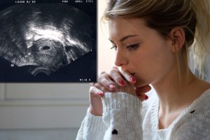 "Я не хотела ребенка, но он был" (аборт и постабортный синдром, ПАС)